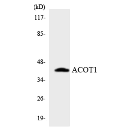 Western Blot - Anti-ACOT1 Antibody (R12-2437) - Antibodies.com