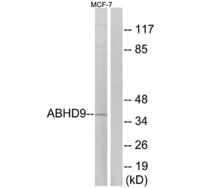 Western Blot - Anti-ABHD9 Antibody (C14221) - Antibodies.com