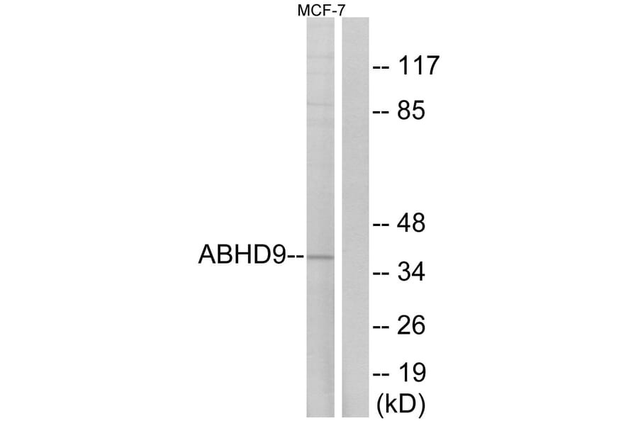 Western Blot - Anti-ABHD9 Antibody (C14221) - Antibodies.com