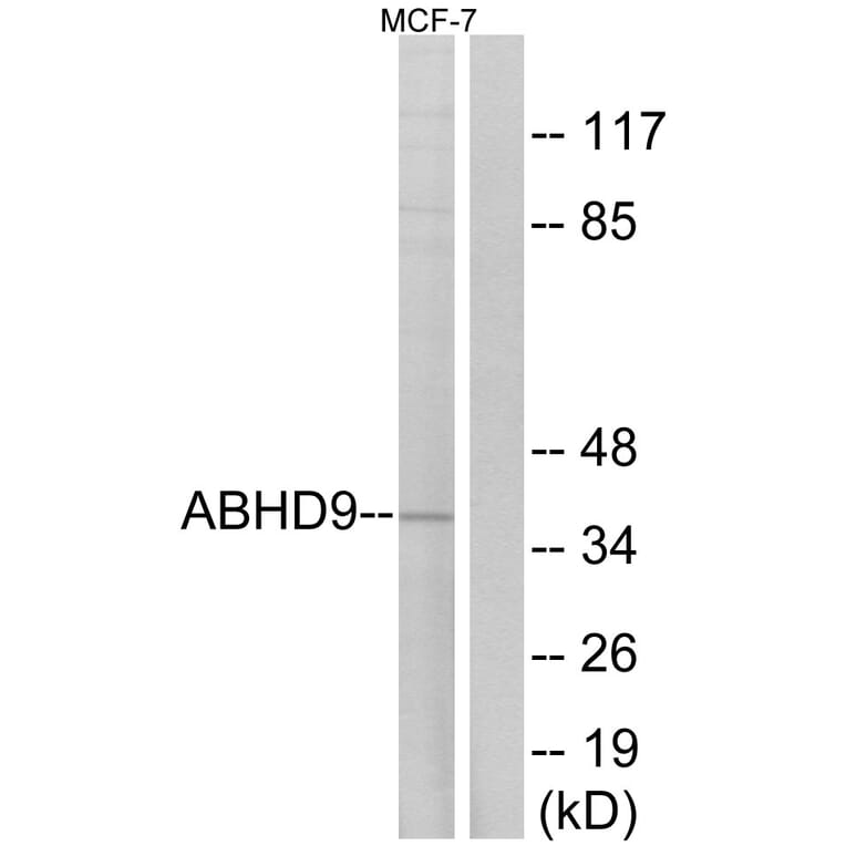 Western Blot - Anti-ABHD9 Antibody (C14221) - Antibodies.com