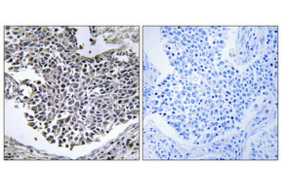 Immunohistochemistry - Anti-ABHD9 Antibody (C14221) - Antibodies.com