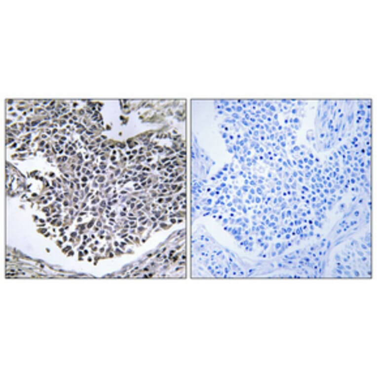 Immunohistochemistry - Anti-ABHD9 Antibody (C14221) - Antibodies.com