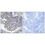 Immunohistochemistry - Anti-ABHD9 Antibody (C14221) - Antibodies.com