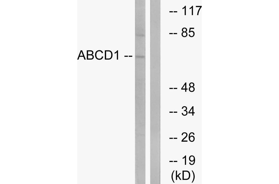 Western Blot - Anti-ABCD1 Antibody (C14624) - Antibodies.com