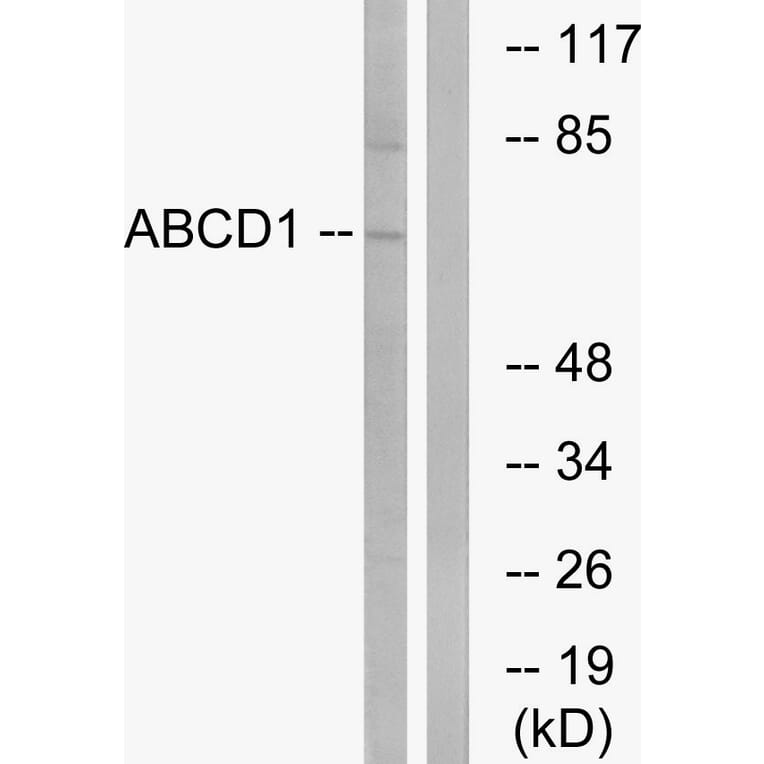 Western Blot - Anti-ABCD1 Antibody (C14624) - Antibodies.com