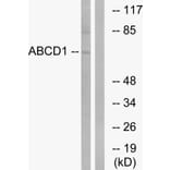 Western Blot - Anti-ABCD1 Antibody (C14624) - Antibodies.com