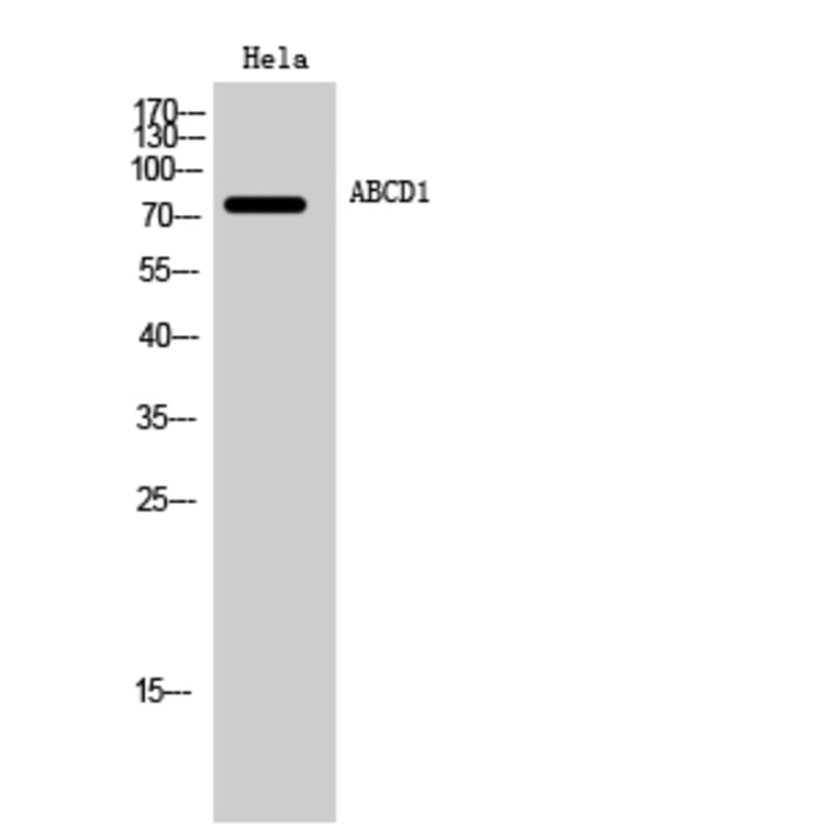 Western Blot - Anti-ABCD1 Antibody (C14624) - Antibodies.com