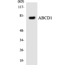 Western Blot - Anti-ABCD1 Antibody (R12-2427) - Antibodies.com