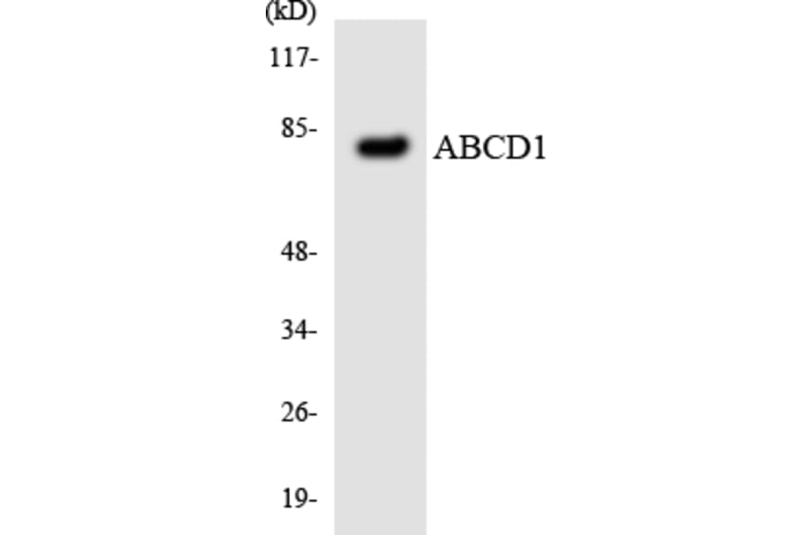 Western Blot - Anti-ABCD1 Antibody (R12-2427) - Antibodies.com