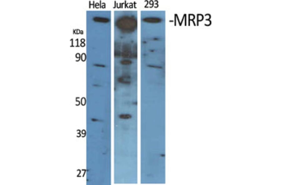 Western Blot - Anti-ABCC3 Antibody (C14907) - Antibodies.com
