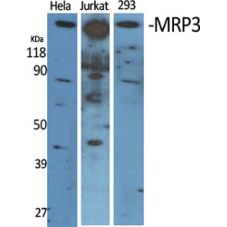 Western Blot - Anti-ABCC3 Antibody (C14907) - Antibodies.com