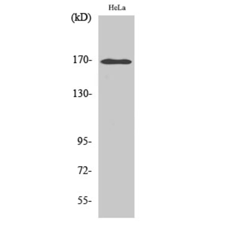 Western Blot - Anti-ABCC3 Antibody (C14907) - Antibodies.com