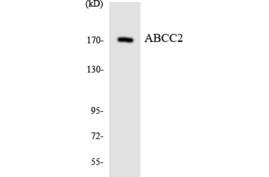 Western Blot - Anti-ABCC2 Antibody (R12-2426) - Antibodies.com