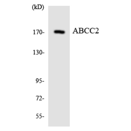 Western Blot - Anti-ABCC2 Antibody (R12-2426) - Antibodies.com