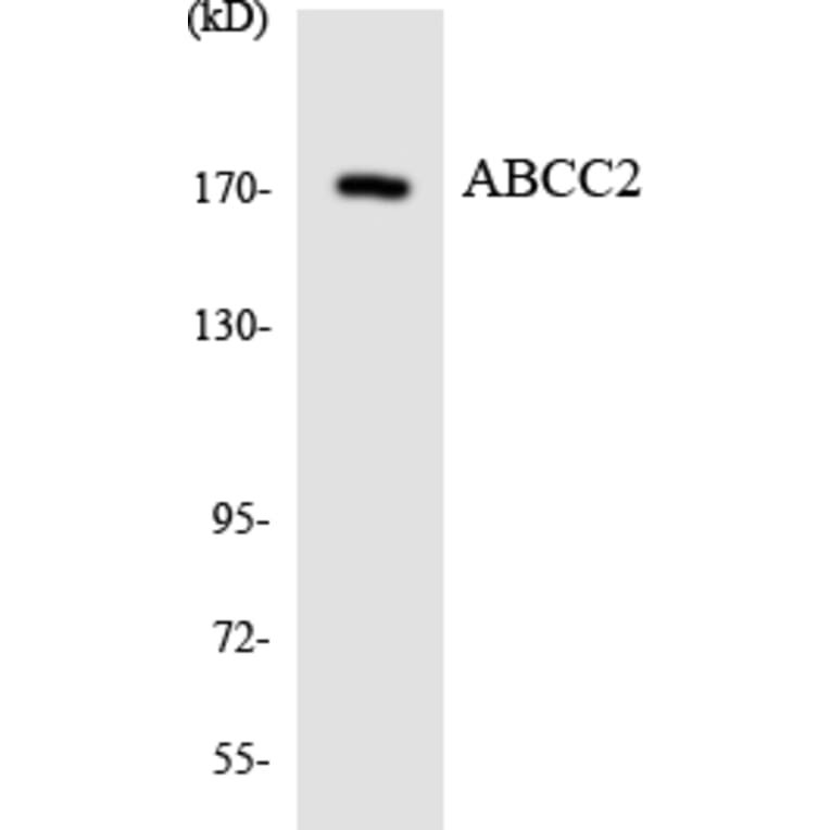 Western Blot - Anti-ABCC2 Antibody (R12-2426) - Antibodies.com