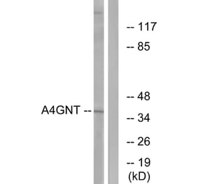 Western Blot - Anti-A4GNT Antibody (C14412) - Antibodies.com