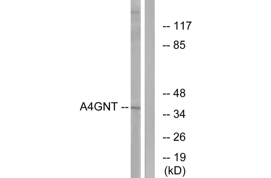 Western Blot - Anti-A4GNT Antibody (C14412) - Antibodies.com