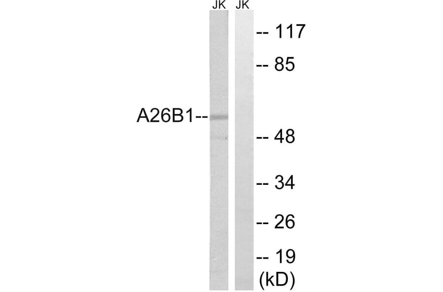 Western Blot - Anti-A26B1 Antibody (C17977) - Antibodies.com