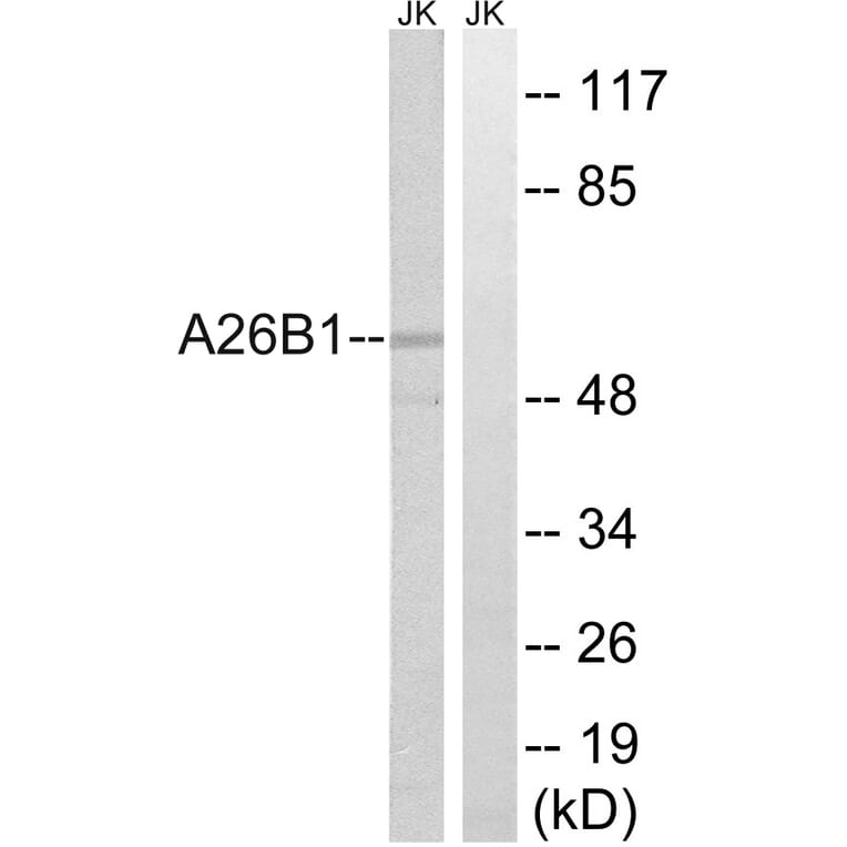 Western Blot - Anti-A26B1 Antibody (C17977) - Antibodies.com