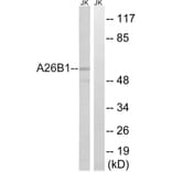 Western Blot - Anti-A26B1 Antibody (C17977) - Antibodies.com