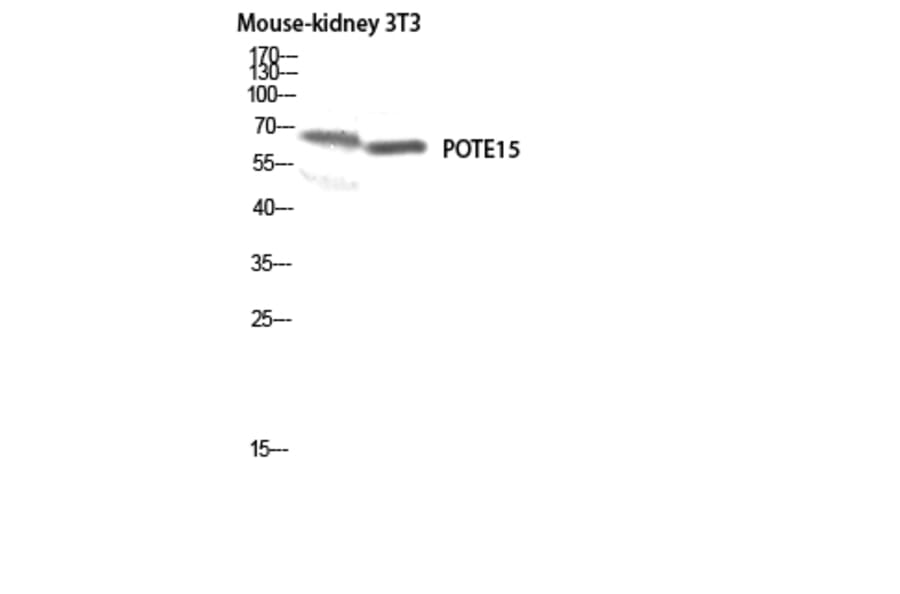 Western Blot - Anti-A26B1 Antibody (C17977) - Antibodies.com