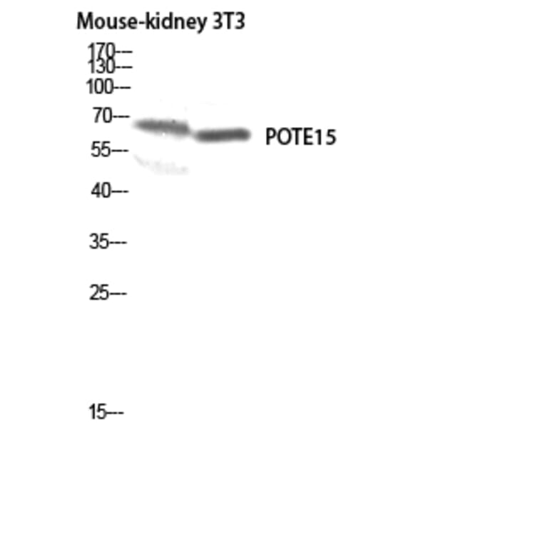 Western Blot - Anti-A26B1 Antibody (C17977) - Antibodies.com