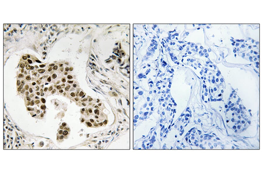 Immunohistochemistry - Anti-PMS2 Antibody (C18035) - Antibodies.com