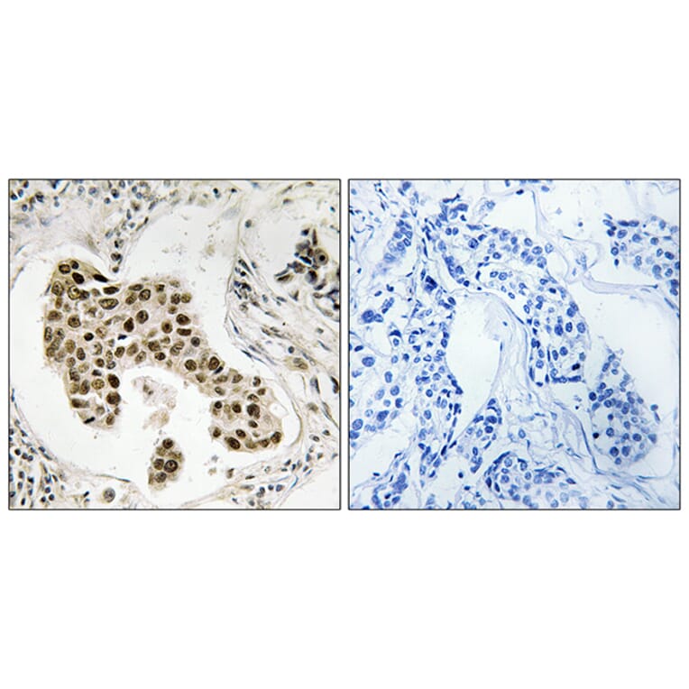 Immunohistochemistry - Anti-PMS2 Antibody (C18035) - Antibodies.com
