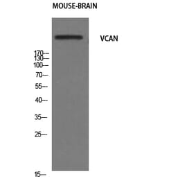 Western Blot - Anti-VCAN Antibody (C19494) - Antibodies.com
