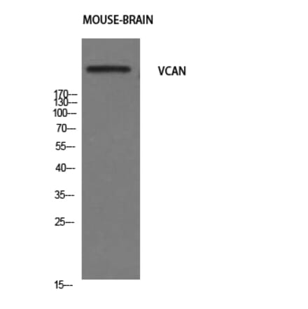 Western Blot - Anti-VCAN Antibody (C19494) - Antibodies.com