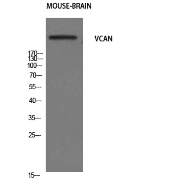 Western Blot - Anti-VCAN Antibody (C19494) - Antibodies.com