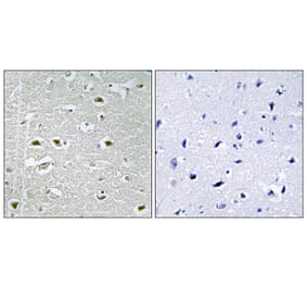 Immunohistochemistry - Anti-URB1 Antibody (C17153) - Antibodies.com