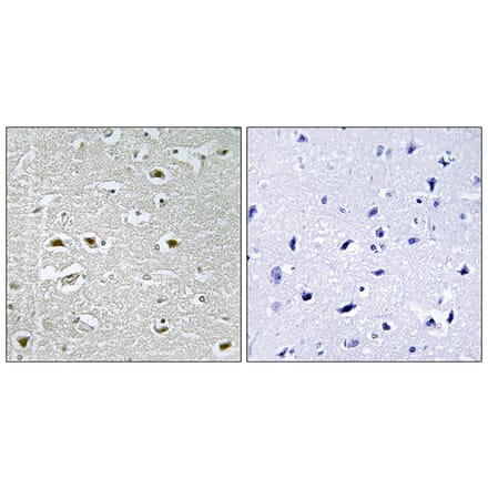 Immunohistochemistry - Anti-URB1 Antibody (C17153) - Antibodies.com