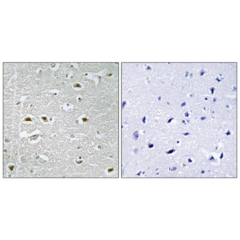 Immunohistochemistry - Anti-URB1 Antibody (C17153) - Antibodies.com