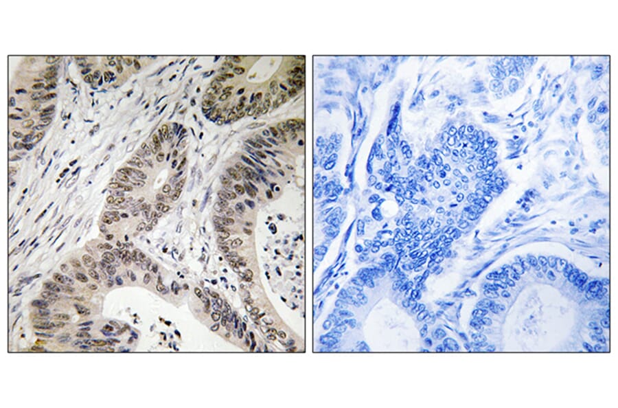 Immunohistochemistry - Anti-TUT1 Antibody (C19350) - Antibodies.com