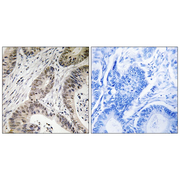 Immunohistochemistry - Anti-TUT1 Antibody (C19350) - Antibodies.com