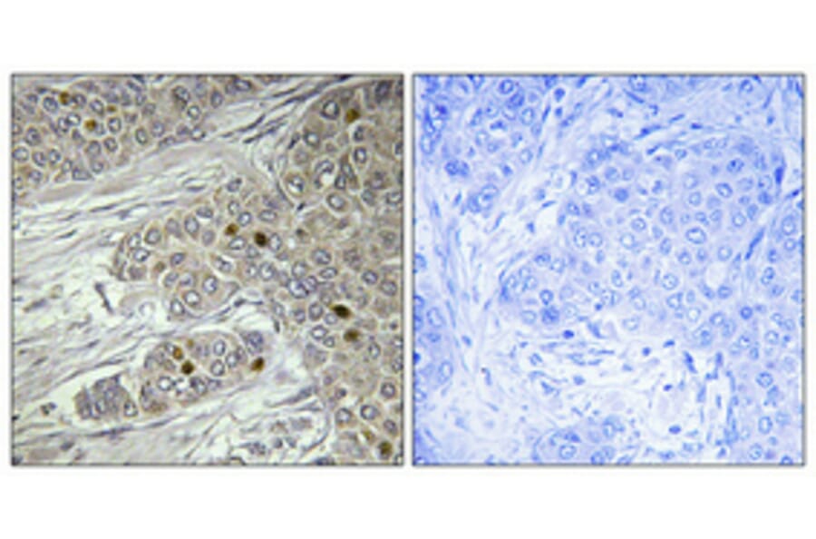 Immunohistochemistry - Anti-TTF1 Antibody (C11075) - Antibodies.com