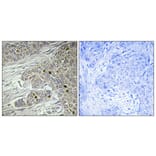 Immunohistochemistry - Anti-TTF1 Antibody (C11075) - Antibodies.com