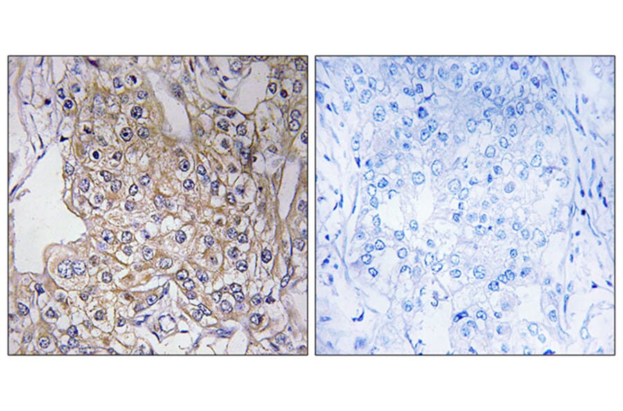 Immunohistochemistry - Anti-TNXB Antibody (C19096) - Antibodies.com