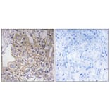 Immunohistochemistry - Anti-TNXB Antibody (C19096) - Antibodies.com