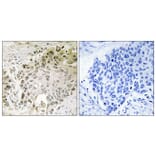 Immunohistochemistry - Anti-RFX2 Antibody (C15456) - Antibodies.com