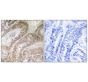Immunohistochemistry - Anti-RDM1 Antibody (C18139) - Antibodies.com