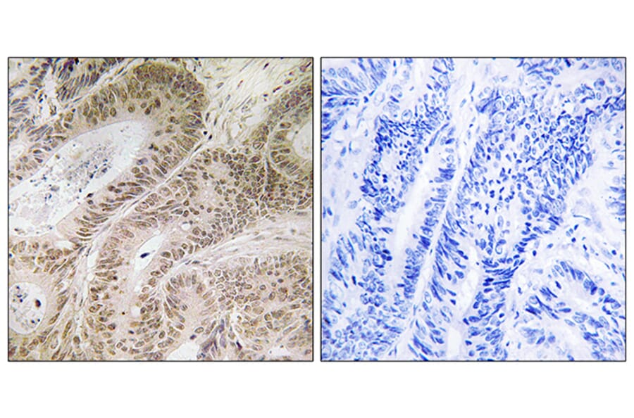 Immunohistochemistry - Anti-RDM1 Antibody (C18139) - Antibodies.com