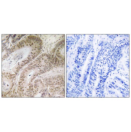 Immunohistochemistry - Anti-RDM1 Antibody (C18139) - Antibodies.com