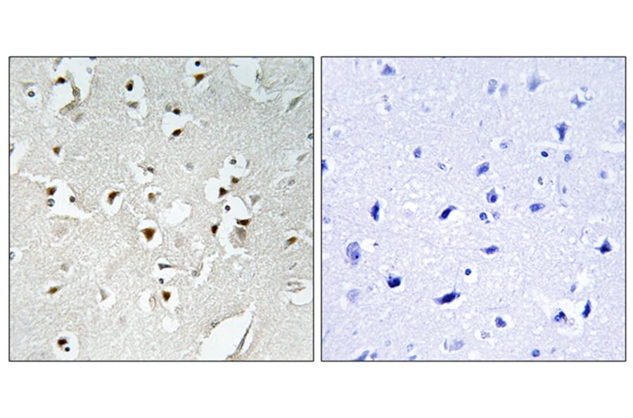 Immunohistochemistry - Anti-PMS1 Antibody (C13103) - Antibodies.com