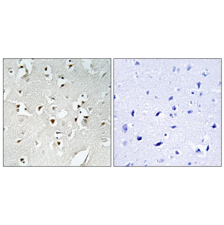 Immunohistochemistry - Anti-PMS1 Antibody (C13103) - Antibodies.com