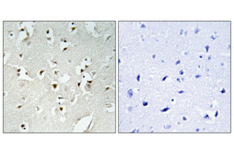 Immunohistochemistry - Anti-PMS1 Antibody (C13103) - Antibodies.com