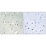 Immunohistochemistry - Anti-PMS1 Antibody (C13103) - Antibodies.com