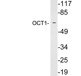 Western Blot - Anti-OCT1 Antibody (R12-2282) - Antibodies.com