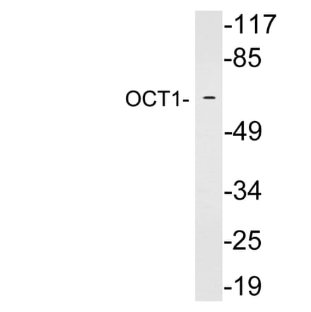 Western Blot - Anti-OCT1 Antibody (R12-2282) - Antibodies.com